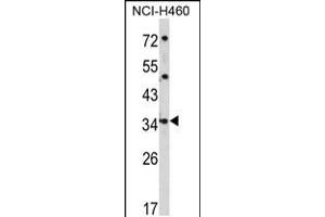 Western blot analysis of CER1 Antibody in NCI-H460 cell line lysates (35ug/lane) (CER1 anticorps  (N-Term))