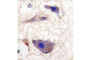 Formalin-fixed and paraffin-embedded human brain tissue reacted with Nptx1 Antibody (C-term), which was peroxidase-conjugated to the secondary antibody, followed by DAB staining.