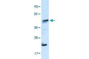 Western Blot analysis of human fetal skeletal muscle tissue lysate with IKZF5 polyclonal antibody  at 0. (IKZF5 anticorps  (N-Term))