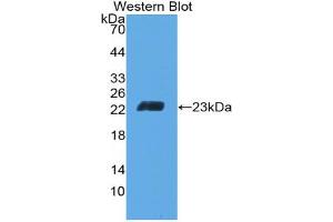 Western blot analysis of the recombinant protein. (CD6 anticorps  (AA 30-204))