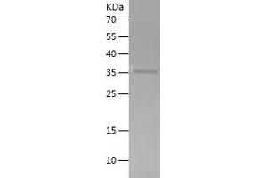Western Blotting (WB) image for Vang-Like 2 (VANGL2) (AA 1-140) protein (His-IF2DI Tag) (ABIN7125696)