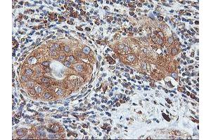 Image no. 10 for anti-IlvB (Bacterial Acetolactate Synthase)-Like (ILVBL) antibody (ABIN1498878) (ILVBL anticorps)