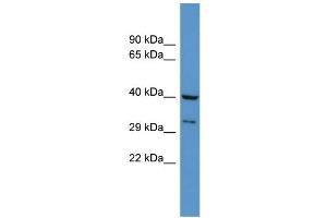 WB Suggested Anti-Dusp11 Antibody Titration: 0. (DUSP11 anticorps  (N-Term))