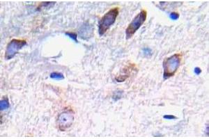 Immunohistochemistry (IHC) analyzes of p-PDGFR beta antibody in paraffin-embedded human brain tissue. (PDGFRB anticorps  (pTyr751))