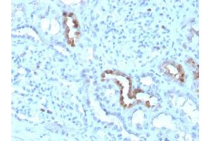 Formalin-fixed, paraffin-embedded human Kidney stained with Calbindin 1 Mouse Monoclonal Antibody (CALB1/3333).