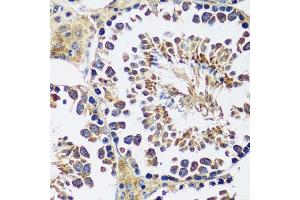 Immunohistochemistry of paraffin-embedded mouse testis using CCDC124 antibody  at dilution of 1:100 (40x lens). (CCDC124 anticorps  (AA 1-223))