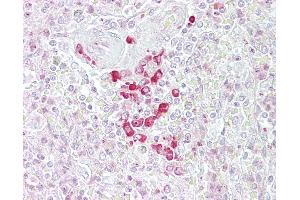 Anti-FRZB antibody IHC of human spleen. (FRZB anticorps  (AA 216-265))