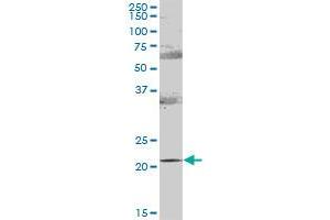 RAB31 MaxPab polyclonal antibody.