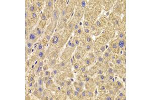Immunohistochemistry of paraffin-embedded human liver injury using PEX5 antibody (ABIN5973402) at dilution of 1/100 (40x lens). (PEX5 anticorps)