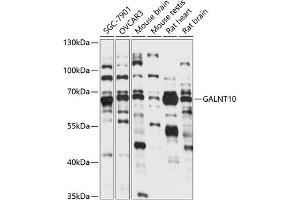 Western blot analysis of extracts of various cell lines, using G antibody (ABIN7271208) at 1:1000 dilution. (GALNT10 anticorps  (AA 444-603))