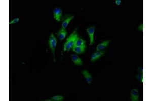 Immunofluorescence staining of Hela cells with ABIN7164700 at 1:33, counter-stained with DAPI. (HBEGF anticorps  (AA 63-148))