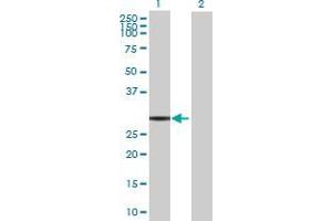 Lane 1: FAM108B1 transfected lysate ( 31.