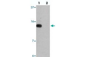 Western blot analysis of DDA1 in mouse heart tissue with DDA1 polyclonal antibody  at 1 ug/mL in (lane 1) the absence and (lane 2) the presence of blocking peptide. (DDA1 anticorps  (C-Term))