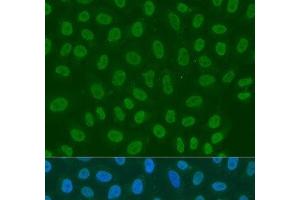 Immunofluorescence analysis of U2OS cells using LSM2 Polyclonal Antibody at dilution of 1:100. (LSM2 anticorps)