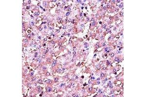 IGF1 antibody immunohistochemistry analysis in formalin fixed and paraffin embedded human liver tissue.