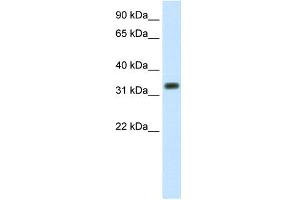 WB Suggested Anti-SIAH1 Antibody Titration:  1. (SIAH1 anticorps  (C-Term))