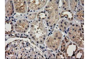 Image no. 4 for anti-Acyl-CoA Thioesterase 12 (ACOT12) antibody (ABIN1496415)