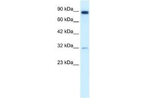 MMP9 antibody used at 1.