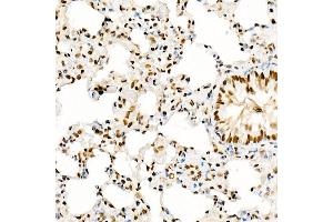 Immunohistochemistry of paraffin-embedded rat lung using KA Rabbit pAb (ABIN1679964, ABIN5664011, ABIN5664013 and ABIN6219456) at dilution of 1:50 (40x lens).