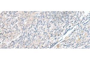 Immunohistochemistry of paraffin-embedded Human tonsil tissue using POMGNT1 Polyclonal Antibody at dilution of 1:55(x200)