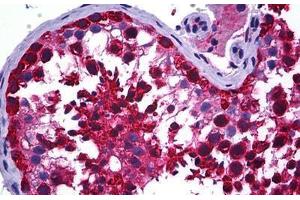 Human Testis: Formalin-Fixed, Paraffin-Embedded (FFPE) (CCT5 anticorps  (AA 1-542))