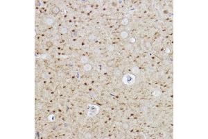 Immunohistochemistry of paraffin-embedded rat brain using Caspase-6 Rabbit mAb (ABIN7266119) at dilution of 1:100 (40x lens). (Caspase 6 anticorps)