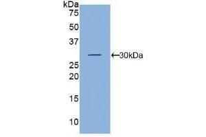 Detection of Recombinant KLK5, Mouse using Polyclonal Antibody to Kallikrein 5 (KLK5) (Kallikrein 5 anticorps  (AA 25-261))