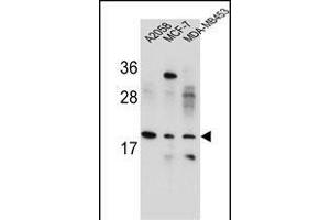 VCX1/VCX2/VCX3 Antibody (N-term) (ABIN654781 and ABIN2844462) western blot analysis in ,MCF-7,MDA-M cell line lysates (35 μg/lane). (VCX anticorps  (N-Term))