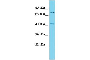 Host: Rabbit Target Name: ACTR8 Sample Type: Jurkat Whole Cell lysates Antibody Dilution: 1. (ACTR8 anticorps  (N-Term))
