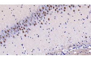 Detection of MAP2K4 in Rat Cerebrum Tissue using Polyclonal Antibody to Mitogen Activated Protein Kinase Kinase 4 (MAP2K4)
