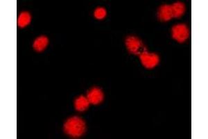 Immunofluorescent analysis of MSH6 staining in HeLa cells. (MSH6 anticorps  (Center))