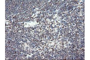 Image no. 3 for anti-Transducin-Like Enhancer of Split 1 (E(sp1) Homolog, Drosophila) (TLE1) (AA 180-460) antibody (ABIN1491050)