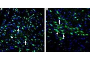Expression of LRRK2 in rat striatum and substantia nigra - Immunohistochemical staining of perfusion-fixed frozen rat brain sections using Anti-LRRK2 Antibody (ABIN7044716 and ABIN7044717), (1:400), followed by goat-anti-rabbit-AlexaFluor-488 secondary antibody. (LRRK2 anticorps  (N-Term))