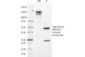 anti-Integrin beta 3 (ITGB3) (AA 385-490) antibody