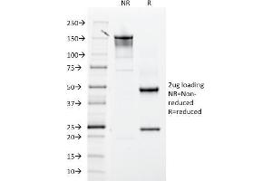 SDS-PAGE Analysis Purified CD61 Mouse Monoclonal Antibody (ITGB3/2145).