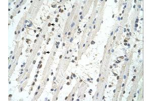 TRIM32 antibody was used for immunohistochemistry at a concentration of 4-8 ug/ml. (TRIM32 anticorps  (C-Term))