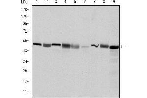 Western blot analysis using CCT2 mouse mAb against Hela (1), MCF-7 (2), Jurkat (3), T47D (4), K562 (5), A431 (6), NIH/3T3 (7), PC-12 (8) and Cos7 (9) cell lysate. (CCT2 anticorps)