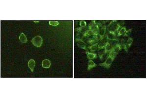 Immunofluorescence staining of methanol-fixed A431 (left) and Hela (right) cells showing cytoplasmic and membrane localization. (MAPK10 anticorps  (AA 28-233))
