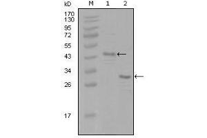 Western Blot showing ESR1 antibody used against truncated Trx-ESR1 recombinant protein (1) and truncated ESR1 (aa130-339)-His recombinant protein (2).