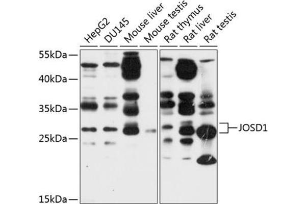 JOSD1 抗体  (AA 1-202)