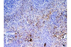 IHC analysis of PF4 using anti-PF4 antibody .