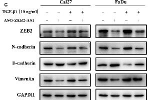 ZEB2-AS1 is involved for TGF-β1-induced EMT in HNSCC cells. (Vimentin anticorps)