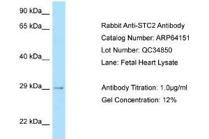 Western Blotting (WB) image for anti-Stanniocalcin 2 (STC2) (C-Term) antibody (ABIN2789750) (Stanniocalcin 2 anticorps  (C-Term))