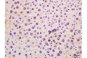 Formalin-fixed and paraffin embedded mouse liver labeled with Anti-SRRM2 Polyclonal Antibody, Unconjugated (ABIN873267) at 1:200 followed by conjugation to the secondary antibody and DAB staining. (SRRM2 anticorps  (AA 101-230))