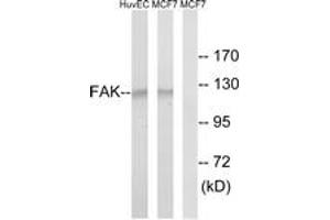 Western blot analysis of extracts from MCF-7/HuvEc cells, using FAK (Ab-843) Antibody. (FAK anticorps  (AA 809-858))