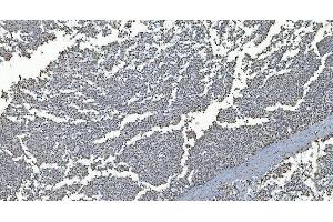 IHC analysis of GRX2/GLRX2 using anti-GRX2/GLRX2 antibody (ABIN7599022). (Glutaredoxin 2 anticorps  (AA 1-164))