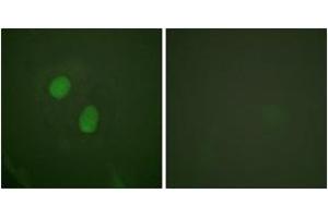 Immunofluorescence analysis of HeLa cells treated with EGF 200nM 5', using Estrogen Receptor-alpha (Phospho-Ser305) Antibody.