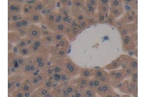 Detection of DKK3 in Mouse Liver Tissue using Polyclonal Antibody to Dickkopf Related Protein 3 (DKK3)