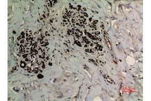 Immunohistochemistry (IHC) analysis of paraffin-embedded Human Breast, antibody was diluted at 1:100.