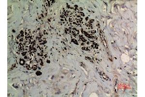 Immunohistochemistry (IHC) analysis of paraffin-embedded Human Breast, antibody was diluted at 1:100. (APEX1 anticorps  (acLys6))